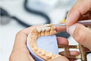 Closeup of dentist in The Colony creating a dental bridge