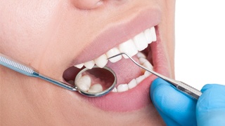 woman getting dental exam