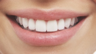 Woman smiling with flawless teeth