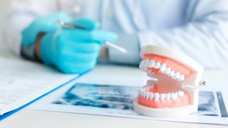 a model of teeth on a dentist’s table 