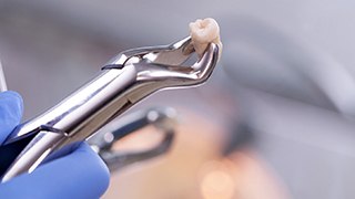 Holding an extracted tooth with dental forceps