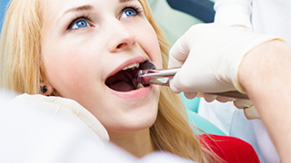 Woman having tooth removed