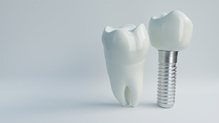 dental implant with crown next to a natural tooth