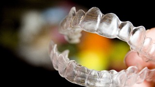 A top and bottom clear aligner used to fix a person’s smile