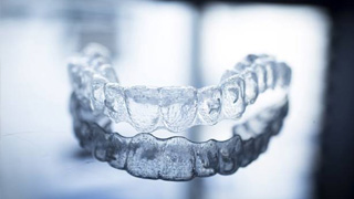 clear aligner