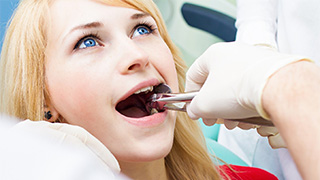 tooth extraction representing cost of root canal in The Colony