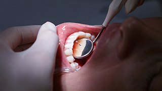 Light shining into patient's mouth