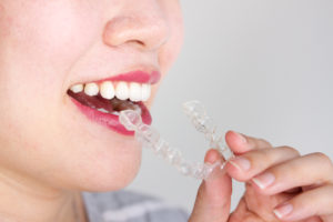 woman inserting Invisalign in The Colony